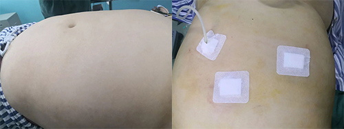 體重200斤的她，選擇了這個減肥方法