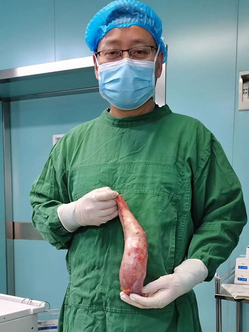 體重200斤的她，選擇了這個減肥方法