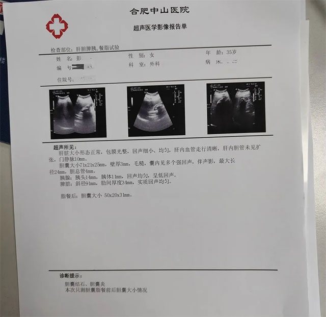 年紀(jì)輕輕不想切除膽囊？來看看這個方法！