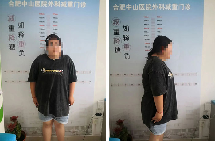 15歲女孩體重達(dá)210多斤，減肥之路我們一同陪伴……