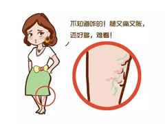 “蚯蚓腿”怎么辦？醫(yī)生：試試這幾種辦法