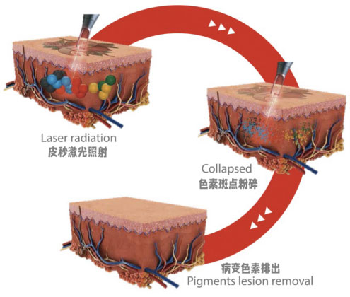 【早點(diǎn)下“斑”，煥膚新生】9.30皮秒日我們不見不散??！!