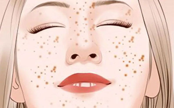 【早點(diǎn)下“斑”，煥膚新生】9.30皮秒日我們不見不散??！!