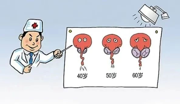 前列腺增生｜從癥狀到治療一文說清！