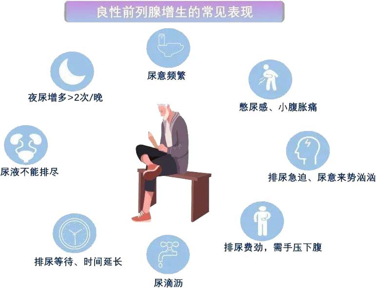 前列腺增生｜從癥狀到治療一文說清！