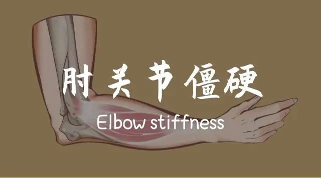 肘關(guān)節(jié)“生銹”，疼痛僵硬活動(dòng)受限，該怎么辦？