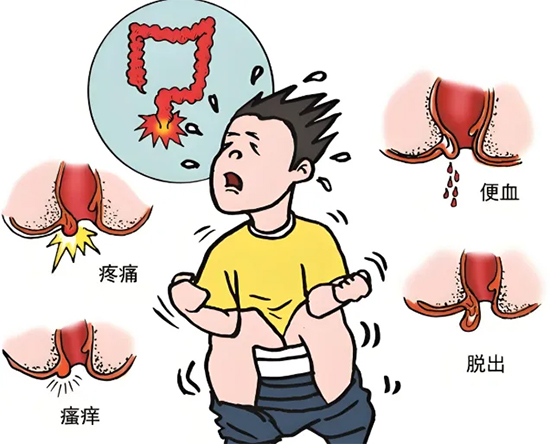 【惠民科普】肛腸疾病無(wú)小事，別因“難言之隱”而忽視了肛腸健康