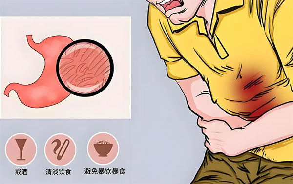 【惠民科普】佳節(jié)將至，警惕胃腸疾病 “搗亂”